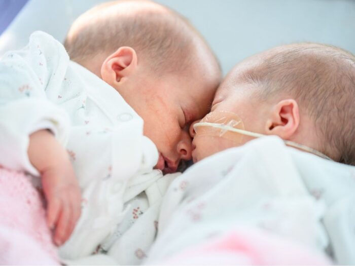 Two baby twins, sleeping next to each other, the baby on the right has a feeding tube attached.