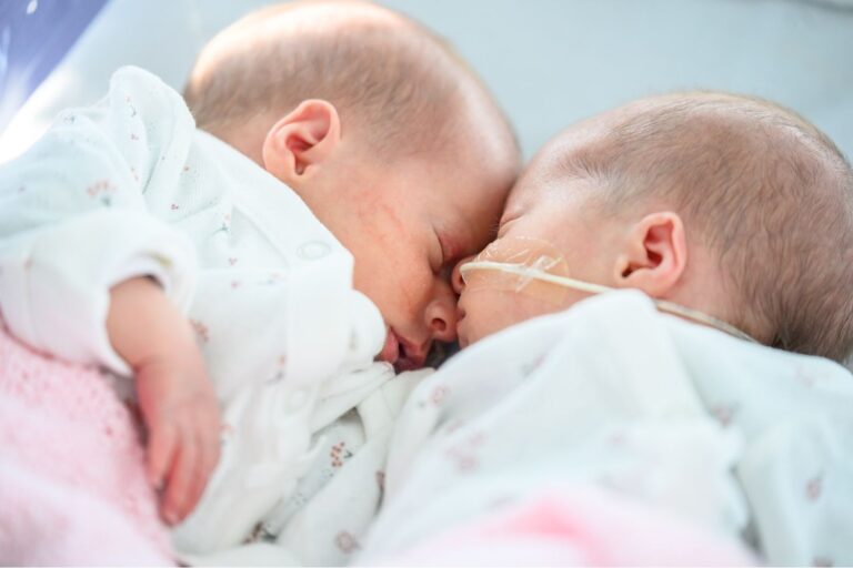 Two baby twins, sleeping next to each other, the baby on the right has a feeding tube attached.