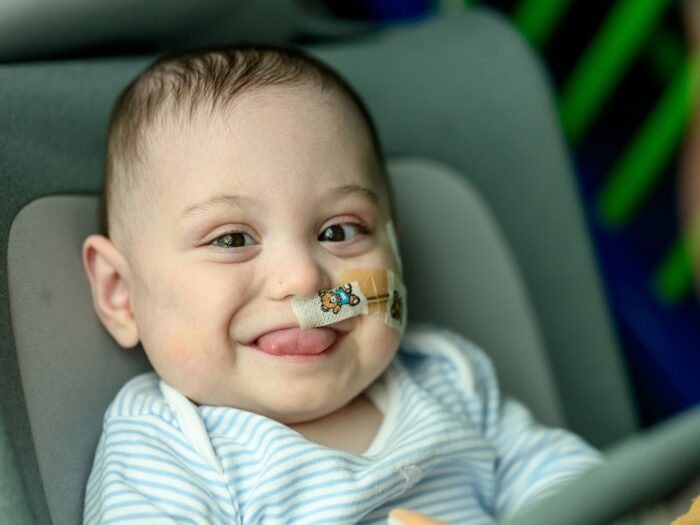 Bertie sat down, smiling with his tongue out a little. In his nostril there is a feeding tube with a colourful plaster.